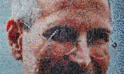 injections_Bradley_Hart_03